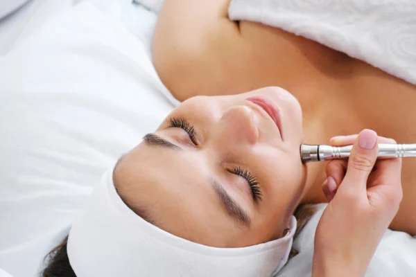 Microdermabrasion