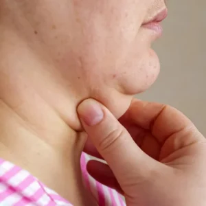 Under Chin 5 ml