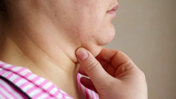 Under Chin 5 ml